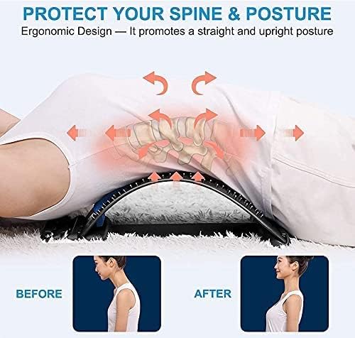 Multi-Level Magic Back Stretcher & Posture Corrector for Pain Relief – Blue